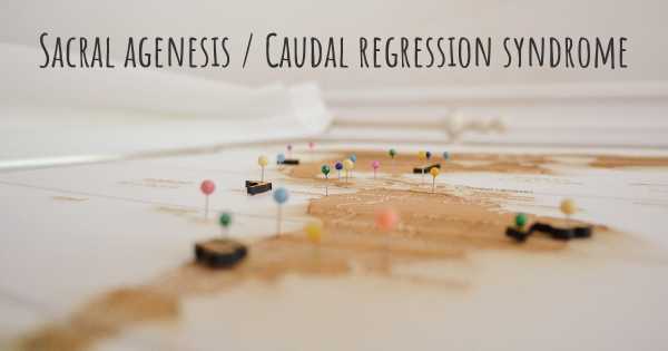Sacral agenesis / Caudal regression syndrome
