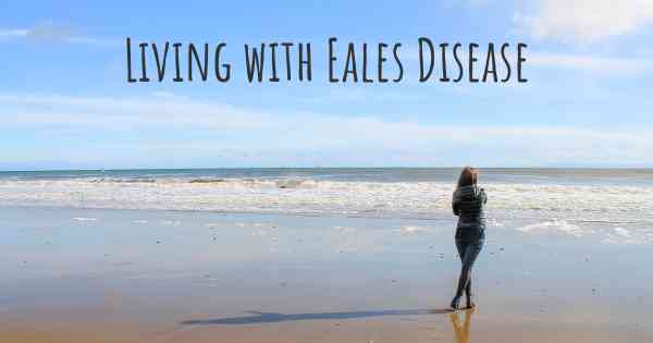 Living with Eales Disease