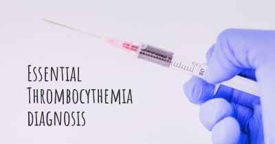 Essential Thrombocythemia diagnosis