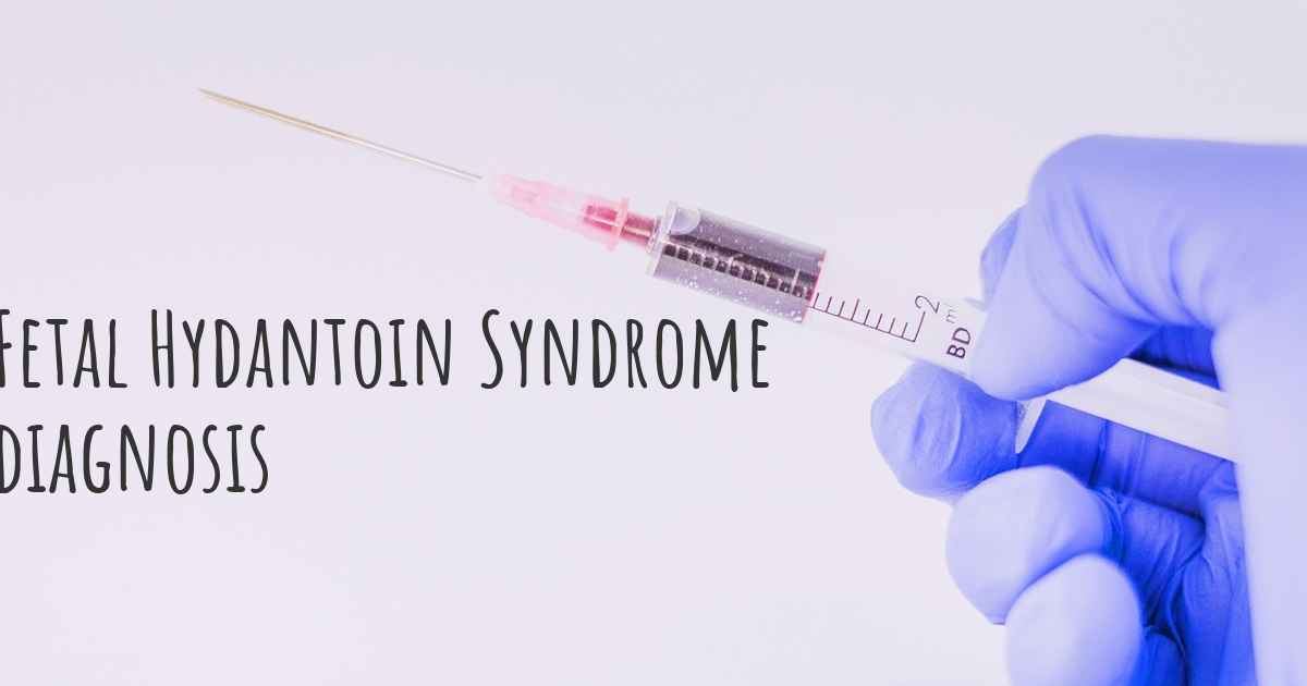 How Is Fetal Hydantoin Syndrome Diagnosed