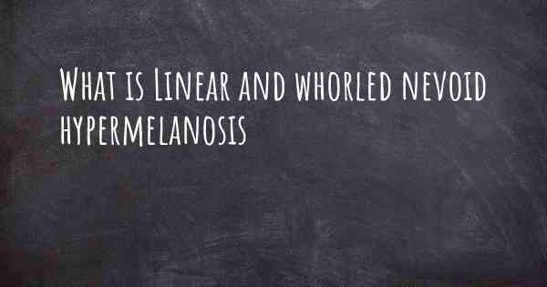 What is Linear and whorled nevoid hypermelanosis