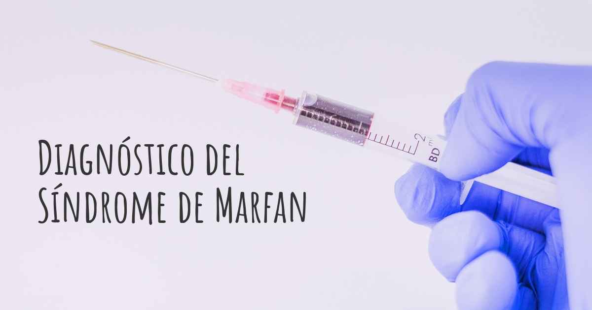 ¿cómo Se Diagnostica El Síndrome De Marfan