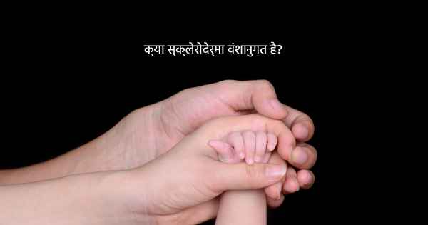 क्या स्क्लेरोदेर्मा वंशानुगत है?