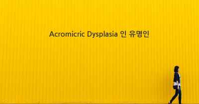 Acromicric Dysplasia 인 유명인