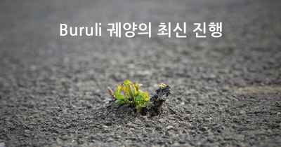 Buruli 궤양의 최신 진행