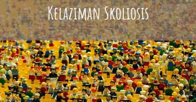 Kelaziman Skoliosis