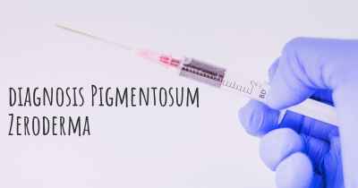 diagnosis Pigmentosum Zeroderma