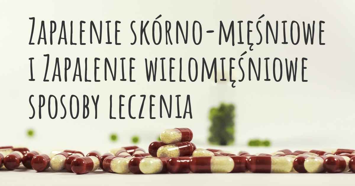 Zapalenie Skórno Mięśniowe I Zapalenie Wielomięśniowe Jakie Są Najlepsze Sposoby Leczenia 0568