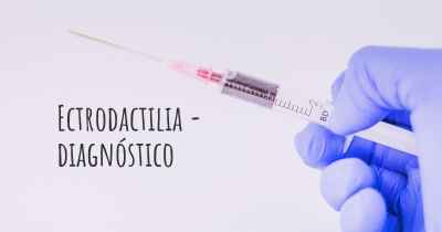 Ectrodactilia - diagnóstico