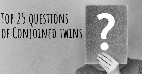 Conjoined twins top 25 questions