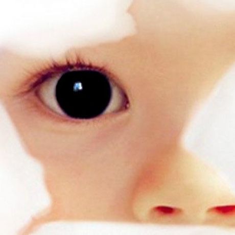 Interregional support center for patients with Aniridia " Iris"