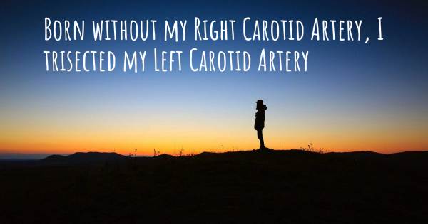 BORN WITHOUT MY RIGHT CAROTID ARTERY, I TRISECTED MY LEFT CAROTID ARTE...
